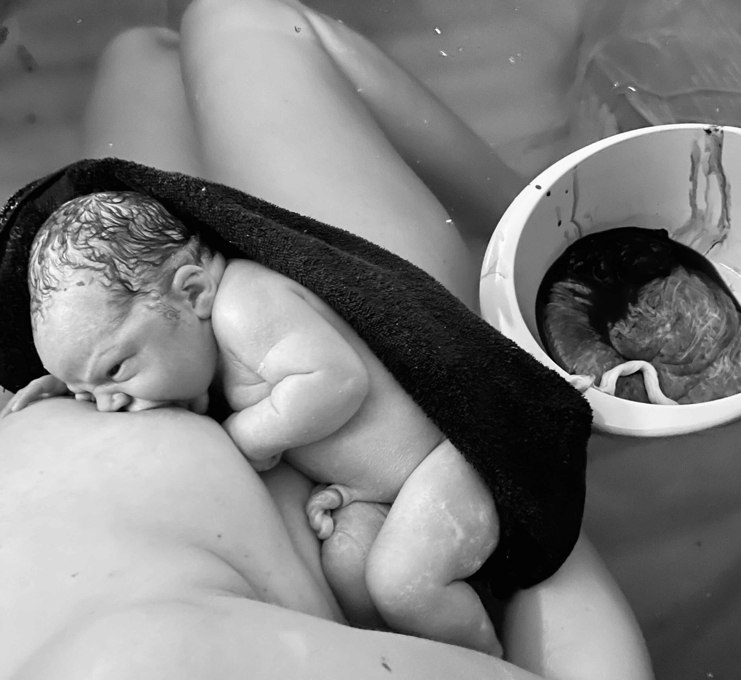 Newborn baby resting on mother's chest moments after birth.